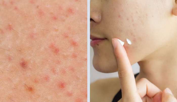 It doesn’t always look bad — but it never feels right.